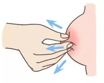 大乳頭、小乳頭、扁平乳頭、凹陷乳頭3大喂養(yǎng)指導(dǎo)及護(hù)理指南！