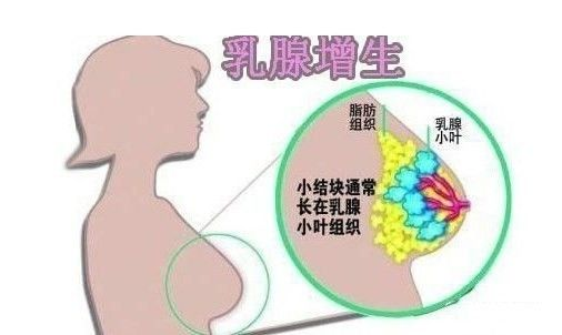 乳房出現(xiàn)“青筋”是什么原因呢？