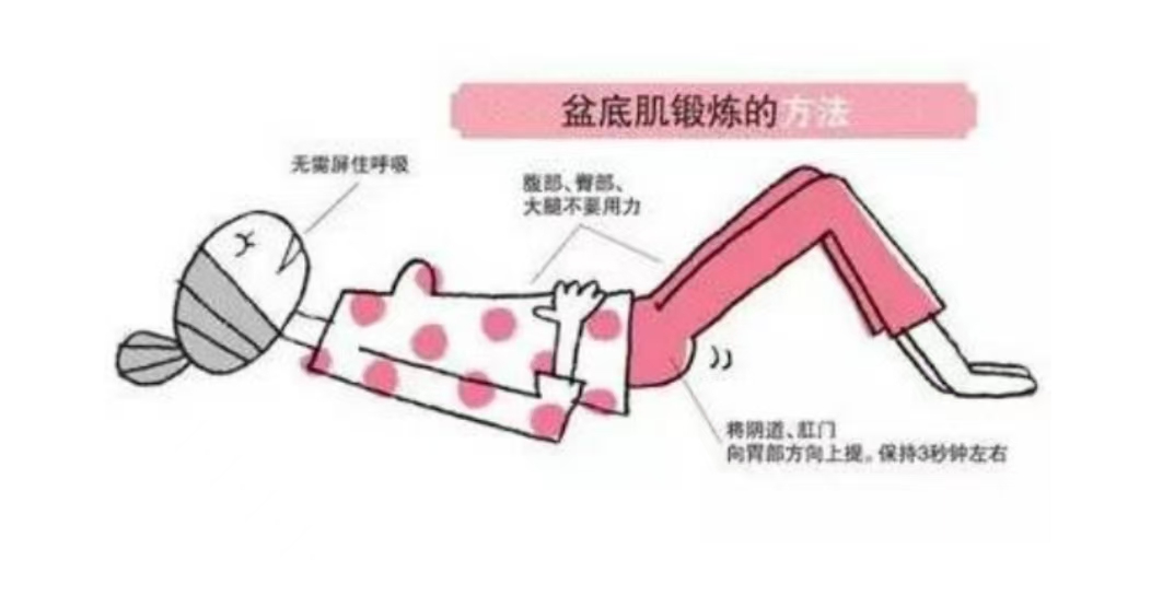 產(chǎn)后如何自己進行盆底肌訓(xùn)練