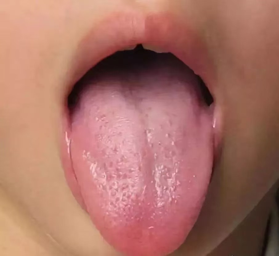 過度喂養(yǎng)危害大，寶寶發(fā)出的積食信號你能看懂多少？