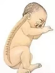 【母嬰知識】“頭”等大事，新生兒枕頭使用須知！