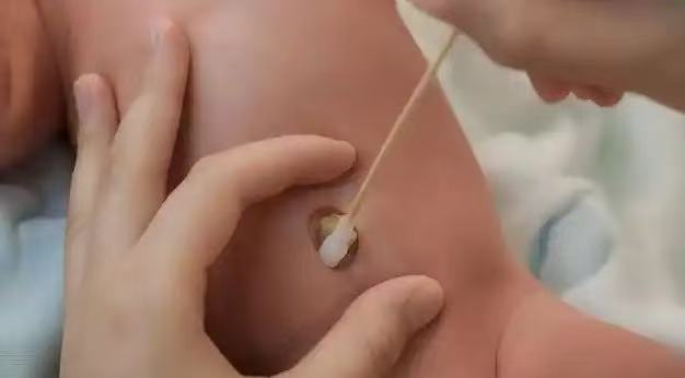  肚臍眼里的污垢，到底能不能摳？ 