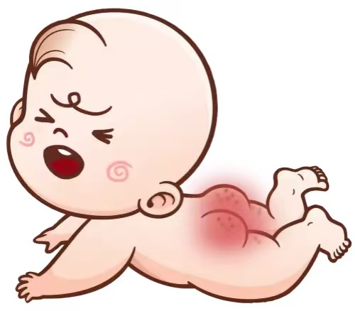 預防寶寶紅屁股四大實用技巧  