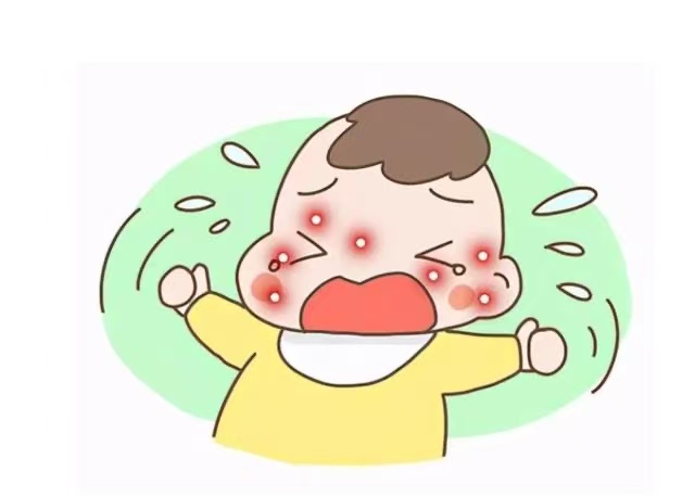 孩子濕疹反復(fù)發(fā)作怎么辦？這些防治方法請(qǐng)收好！
